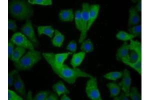 Detection of MHCC in Human Hela Cell using Polyclonal Antibody to Major Histocompatibility Complex Class I C (MHCC) (HLA-C antibody  (AA 48-305))