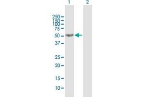 Western Blot analysis of CNDP2 expression in transfected 293T cell line by CNDP2 MaxPab polyclonal antibody. (CNDP2 antibody  (AA 1-475))