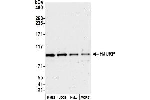 Western Blotting (WB) image for anti-Holliday Junction Recognition Protein (HJURP) (AA 650-700) antibody (ABIN7453582)