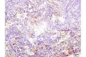 Formalin-fixed and paraffin embedded mouse spleen labeled with Rabbit Anti Kinesin3 Polyclonal Antibody, Unconjugated  at 1:200 followed by conjugation to the secondary antibody and DAB staining (Kinesin antibody  (AA 561-660))