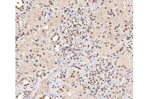 ABIN6267404 at 1/200 staining human kidney tissue sections by IHC-P. (Stathmin 1 antibody  (pSer15))