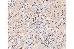 ABIN6267404 at 1/200 staining human kidney tissue sections by IHC-P.