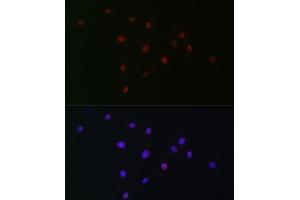 Immunofluorescence analysis of C6 cells using SOX10 Rabbit pAb (ABIN6134484, ABIN6148289 and ABIN7101829) at dilution of 1:100 (40x lens). (SOX10 antibody)