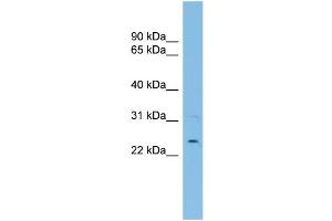 WB Suggested Anti-UBE2E3 Antibody Titration:  0. (UBE2E3 antibody  (N-Term))
