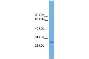 Human heart; WB Suggested Anti-RAB35 Antibody Titration: 0. (RAB35 antibody  (Middle Region))