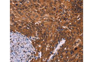 Immunohistochemistry (IHC) image for anti-CDC5 Cell Division Cycle 5-Like (S. Pombe) (CDC5L) antibody (ABIN5544110) (CDC5L antibody)