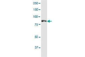 Western Blotting (WB) image for anti-MutL Homolog 1 (MLH1) (AA 1-756) antibody (ABIN561826)