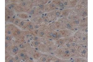 DAB staining on IHC-P; Samples: Human Liver Tissue (Neuroglobin antibody  (AA 1-151))