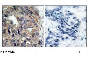 Image no. 1 for anti-Nuclear Receptor Coactivator 1 (NCOA1) (pTyr529) antibody (ABIN196876) (NCOA1 antibody  (pTyr529))