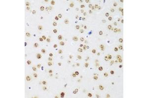 Immunohistochemistry of paraffin-embedded mouse brain using MECP2 antibody. (MECP2 antibody)