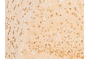 ABIN6267236 at 1/100 staining mouse brain tissue sections by IHC-P. (MAP3K7 antibody  (pThr187))