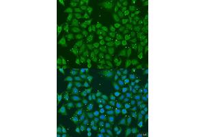 Immunofluorescence analysis of U2OS cells using AKR7A3 antibody. (AKR7A3 antibody  (AA 1-331))