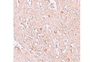 Immunohistochemical staining of human spleen cells with FBXL16 polyclonal antibody  at 5 ug/mL.
