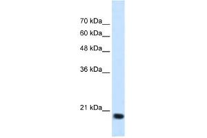 WB Suggested Anti-SSR2 Antibody Titration:  1.
