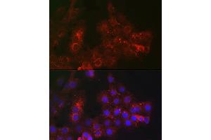 Immunofluorescence analysis of  cells using TROP-2 Rabbit pAb (ABIN7271104) at dilution of 1:100 (40x lens). (TACSTD2 antibody  (AA 27-270))