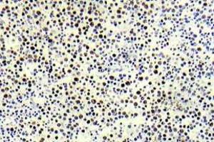 Immunohistochemistry (IHC) analyzes of p-Histone H3. (Histone H3.1 antibody  (pThr3))