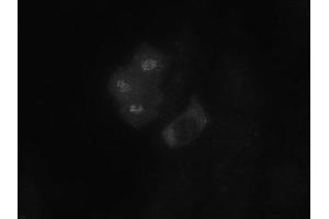 Image no. 1 for anti-Budding Uninhibited By Benzimidazoles 1 Homolog (Yeast) (BUB1) (AA 281-419) antibody (ABIN108553) (BUB1 antibody  (AA 281-419))