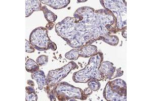 Immunohistochemical staining of human placenta with CRB2 polyclonal antibody  shows strong membranous and cytoplasmic positivity in trophoblastic cells.