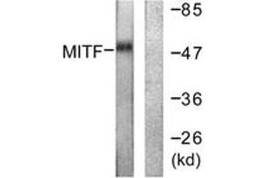 Western blot analysis of extracts from HepG2 cells, using MITF (Ab-180/73) Antibody. (MITF antibody  (AA 151-200))