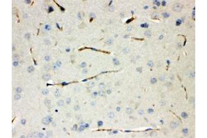 IHC testing of FFPE mouse lung with CGRP antibody. (CGRP antibody)