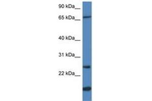 Image no. 1 for anti-Glutathione S-Transferase mu 5 (GSTM5) (N-Term) antibody (ABIN6741032)