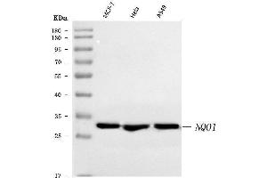 Western blot analysis of NQO1 using anti-NQO1 antibody (ABIN7599200).