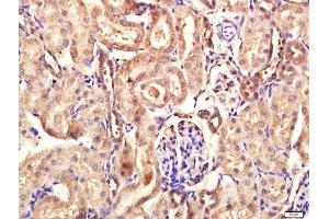 Paraformaldehyde-fixed, paraffin embedded rat kidney tissue, Antigen retrieval by boiling in sodium citrate buffer(pH6) for 15min, Block endogenous peroxidase by 3% hydrogen peroxide for 30 minutes, Blocking buffer (normal goat serum) at 37°C for 20min, Antibody incubation with Rabbit Anti-Calpain 1 Polyclonal Antibody, Unconjugated  at 1:400 overnight at 4°C, followed by a conjugated secondary and DAB staining (CAPN1 antibody  (AA 625-713))