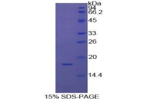 SDS-PAGE analysis of Cow Coagulation Factor IX Protein.