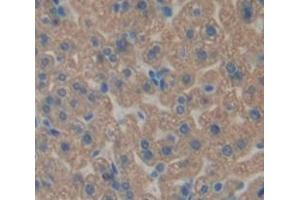 Figure. (HSD17B10 antibody  (AA 4-202))