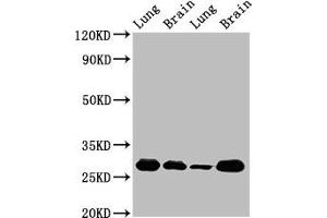 Western Blot Positive WB detected in: Rat lung tissue, Rat brain tissue, Mouse lung tissue, Mouse brain tissue All lanes: SFN antibody at 5 μg/mL Secondary Goat polyclonal to rabbit IgG at 1/50000 dilution Predicted band size: 28, 25 kDa Observed band size: 28 kDa (14-3-3 sigma/SFN antibody  (AA 1-248))