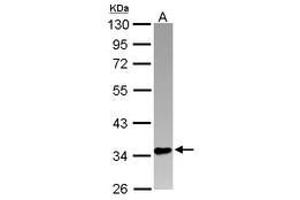 Image no. 1 for anti-PIN2/TERF1 Interacting, Telomerase Inhibitor 1 (PINX1) (AA 1-221) antibody (ABIN1500224) (PINX1 antibody  (AA 1-221))