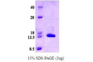 Figure annotation denotes ug of protein loaded and % gel used. (CRABP2 Protein (AA 1-138))