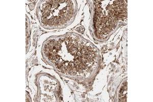 Immunohistochemical staining of human testis with LOC388333 polyclonal antibody  shows moderate cytoplasmic positivity in cells in seminiferus duct cells at 1:10-1:20 dilution. (SPDYE4 antibody)