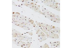 Immunohistochemistry of paraffin-embedded mouse heart using KDM4A antibody (ABIN5975678) at dilution of 1/100 (40x lens). (KDM4A antibody)