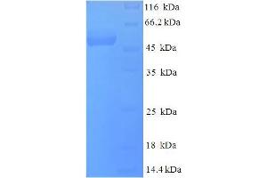 SDS-PAGE (SDS) image for Deoxyuridine Triphosphatase (DUT) (AA 1-278), (full length) protein (His-SUMO Tag) (ABIN5710750)