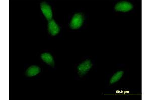 Immunofluorescence of purified MaxPab antibody to MAP2K4 on HeLa cell. (MAP2K4 antibody  (AA 1-399))
