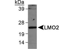 Western blot analysis of LMO2 in Ramos whole cell lysate using LMO2 polyclonal antibody . (LMO2 antibody  (AA 1-100))