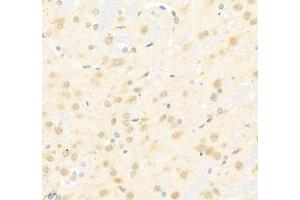 Immunohistochemistry of paraffin embedded rat brain using Arhgap17 (ABIN7075416) at dilution of 1: 700 (400x lens) (ARHGAP17 antibody)