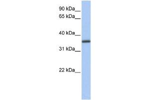 WB Suggested Anti-GALE Antibody Titration: 0.
