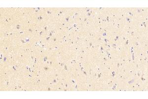 Detection of NMU in Human Cerebrum Tissue using Polyclonal Antibody to Neuromedin U (NMU) (Neuromedin U antibody  (AA 35-158))