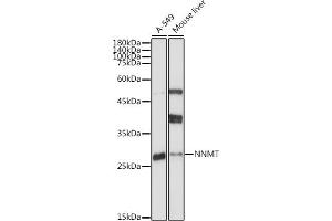 Immunohistochemistry of paraffin-embedded human liver using [KO Validated] NNMT Rabbit pAb (ABIN7268908) at dilution of 1:100 (40x lens). (NNMT antibody  (AA 1-264))