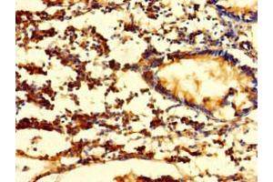 Immunohistochemistry of paraffin-embedded human appendix tissue using ABIN7152778 at dilution of 1:100 (FGF13 antibody  (AA 1-245))