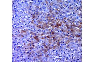 Paraformaldehyde-fixed, paraffin embedded rat liver, Antigen retrieval by boiling in sodium citrate buffer (pH6. (AGTR1a antibody  (AA 101-200))