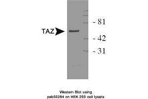 Image no. 1 for anti-Tafazzin (TAZ) antibody (ABIN363593) (TAZ antibody)