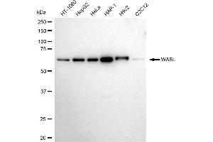 anti-Neural Wiskott-Aldrich syndrome protein (WASL) antibody
