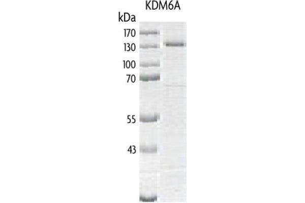 KDM6A Protein (DYKDDDDK Tag)
