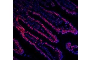 IF analysis of DDX5 using anti-DDX5 antibody (ABIN7602561).