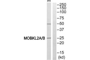 Western blot analysis of extracts from 3T3 cells, using MOBKL2A/B antibody. (MOBKL2A,B (N-Term) antibody)
