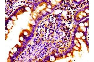 Immunohistochemistry of paraffin-embedded human small intestine tissue using ABIN7161709 at dilution of 1:100 (Norrie Disease (Pseudoglioma) antibody  (AA 25-133))