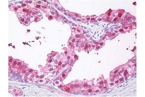 Prostate stained with VPS24 antibody Cat.
